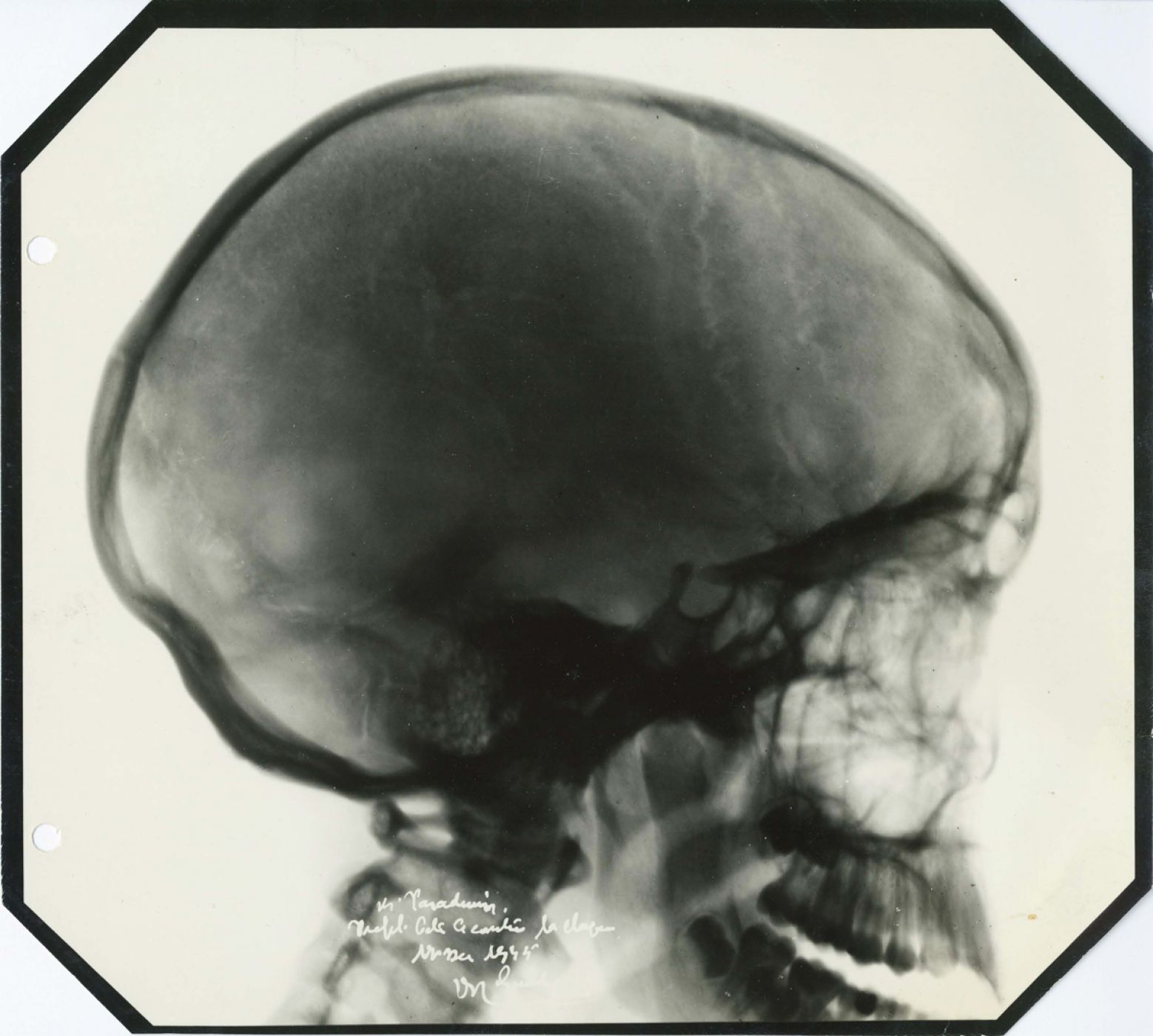 Anonymous, “Base du crâne”, 1935