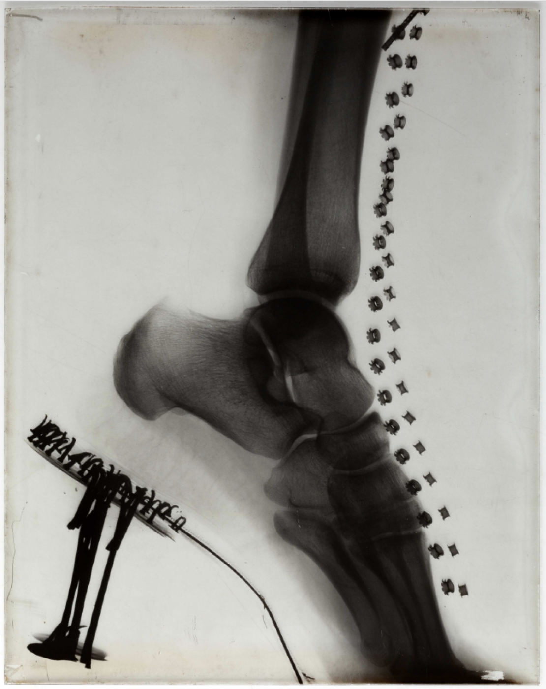Anonymous, &ldquo;X-ray of a woman’s foot in a lace-up boot&rdquo;, 1910 ca.