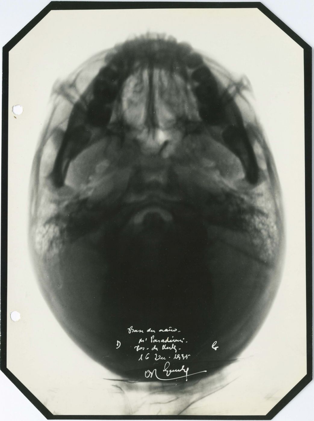 Anonymous, “Base du crâne”, 1935